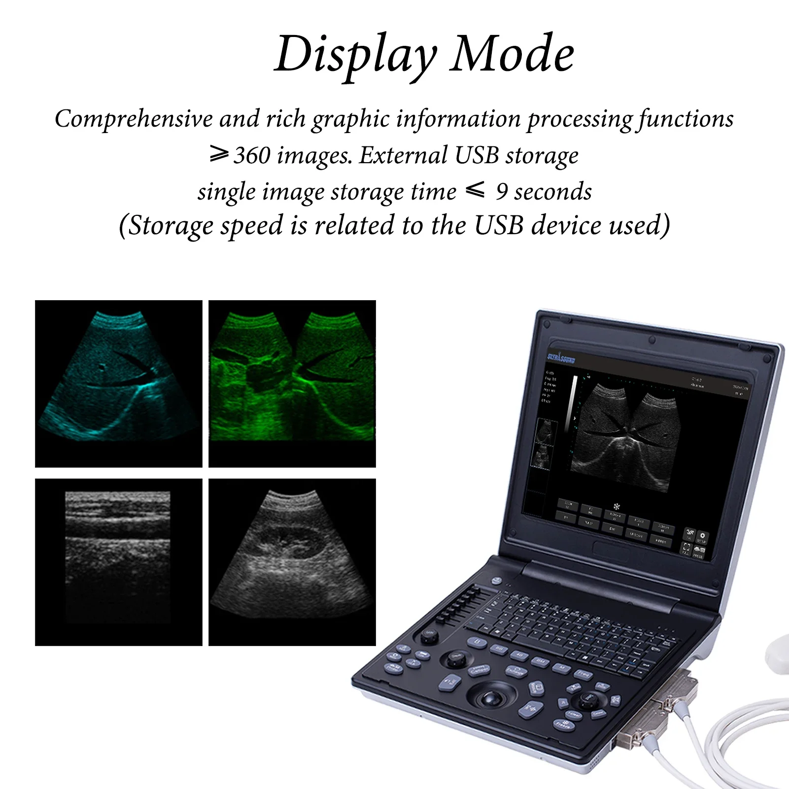 Veterinary B-Ultrasound Machine, Portable Laptop Scanner with 3.5 MHz Micro Convex Probe for Cat Dog,Goat,Cow and Pig Pregnancy