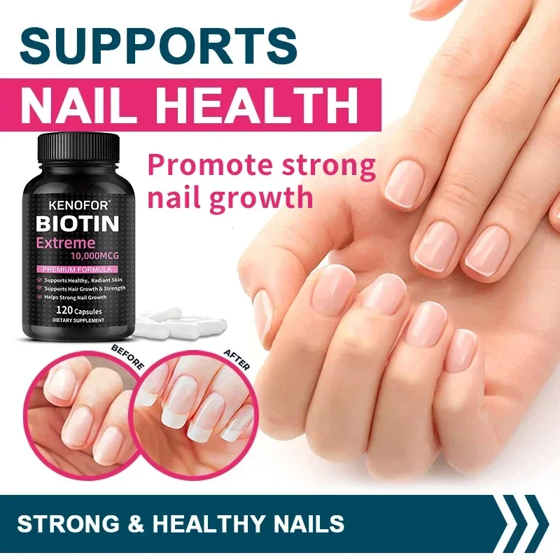 Biotin Capsules 10,000mcg - Maximum Strength, Promotes Healthy Hair, Skin, Nails, Bone and Joint Health