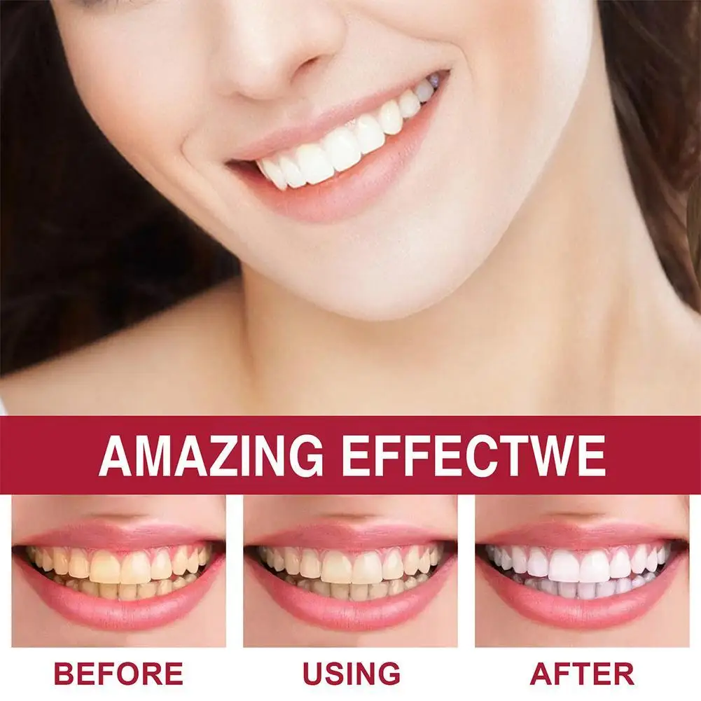 30ml Probiotic Brightening Toothpaste Oral Care Breath Oral Toothpaste Cleaning Fresh Prevents Plaque E7B3