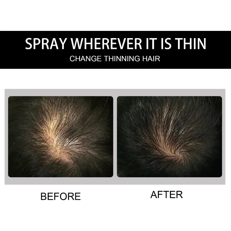 ألياف بناء الشعر 12 جرام لترقق الشعر وتكثيفه وتبدو أكثر كثافة على الفور للنساء والرجال دروبشيبينغ