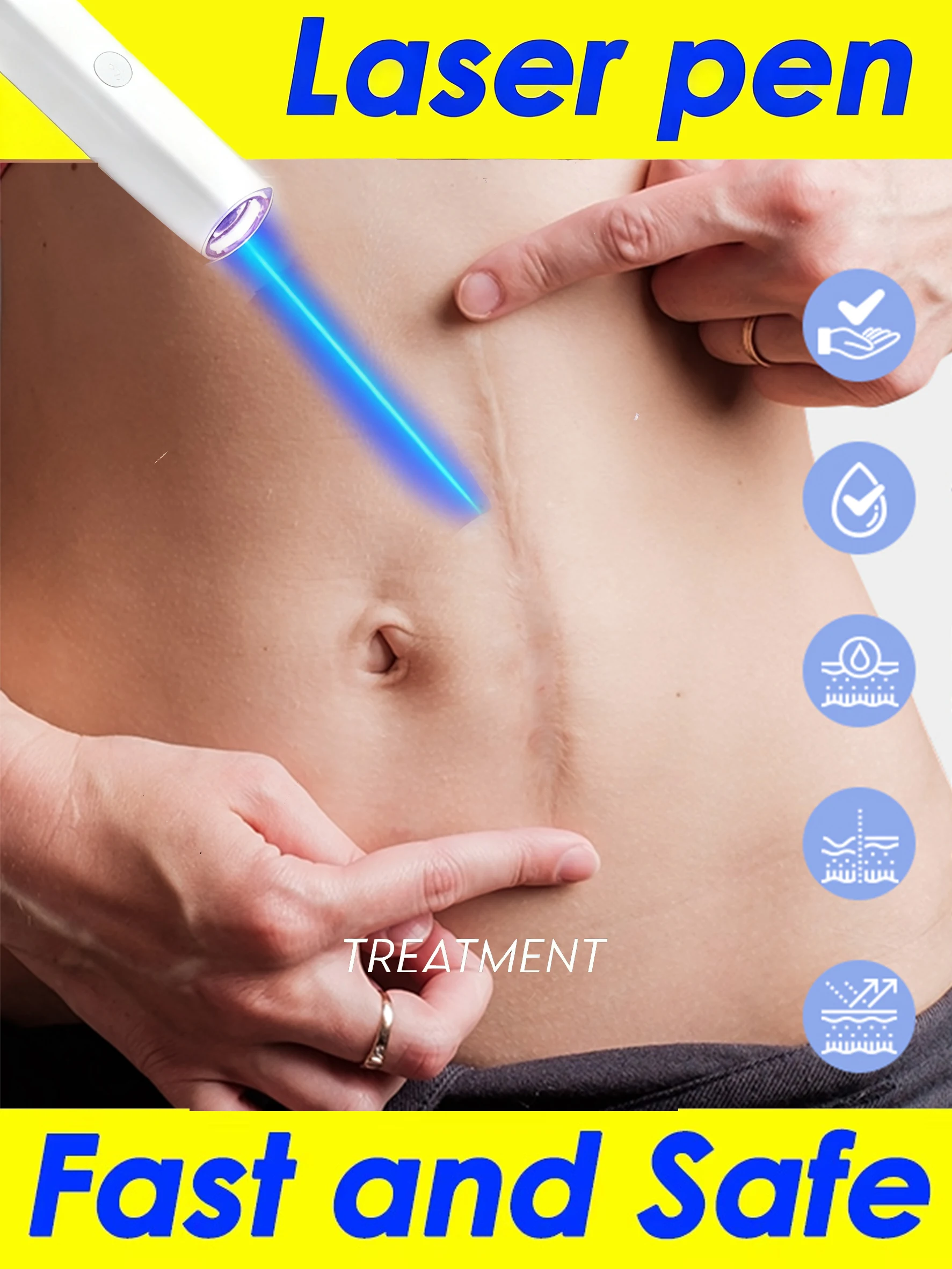 

Scar Blue Light Laser Pen Professional Skin Beauty Care Tool