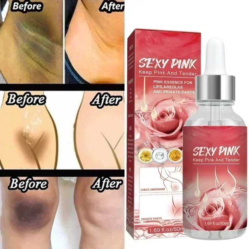 Sexy Pink Serum For Lip Areolas Private Parts Tender Remove Intimate Melanin Women Body Whitening Serum