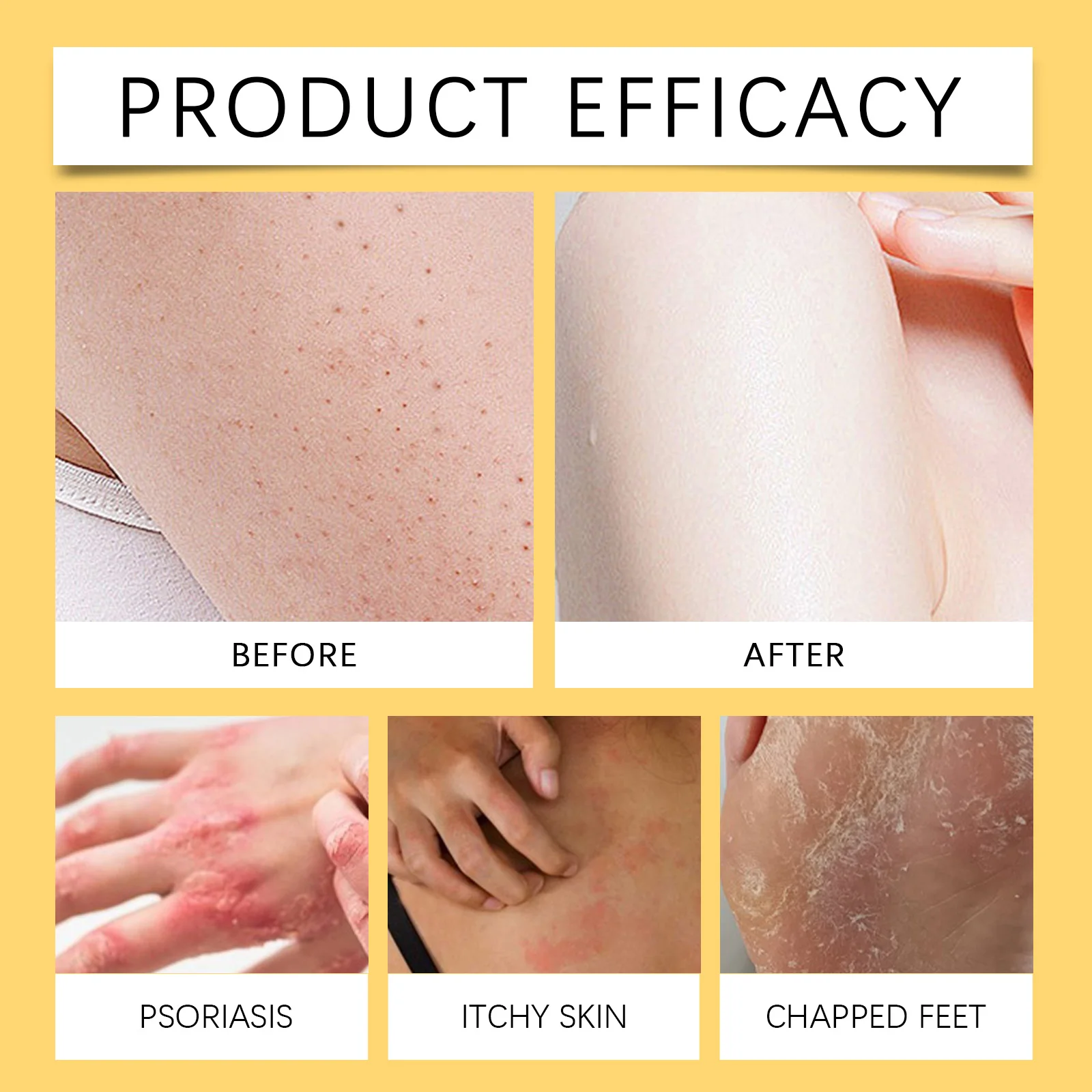 HOYGI كريم سم النحل إصلاح الضرر الجلد تقليل الاحمرار تعزيز حاجز الجلد مغذي ترطيب العناية بالبشرة الحساسة 60 جرام #2