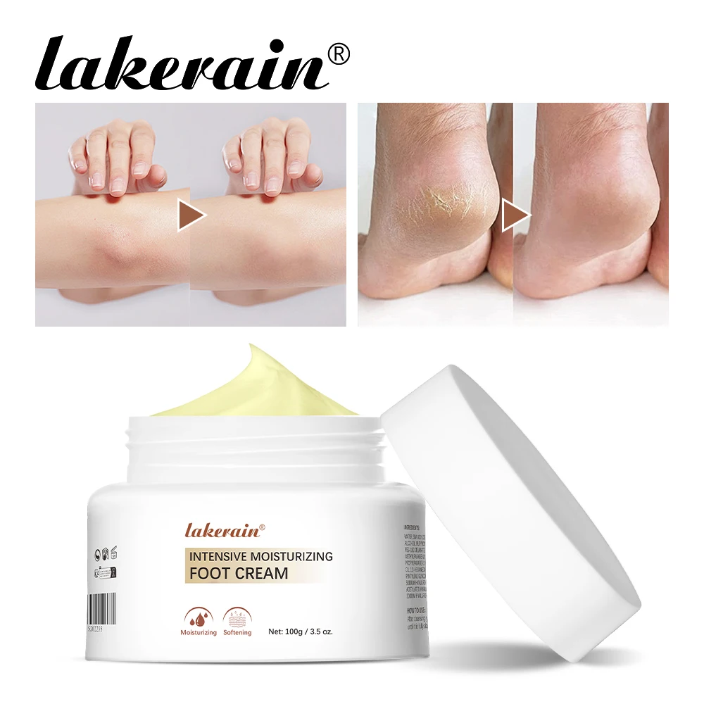 Moisturizing Foot Cream Callus Remover Hand Cream Dry Cracked Feet Hands Heel Elbow Softens Skin Exfoliates Dead Skin Foot Cream