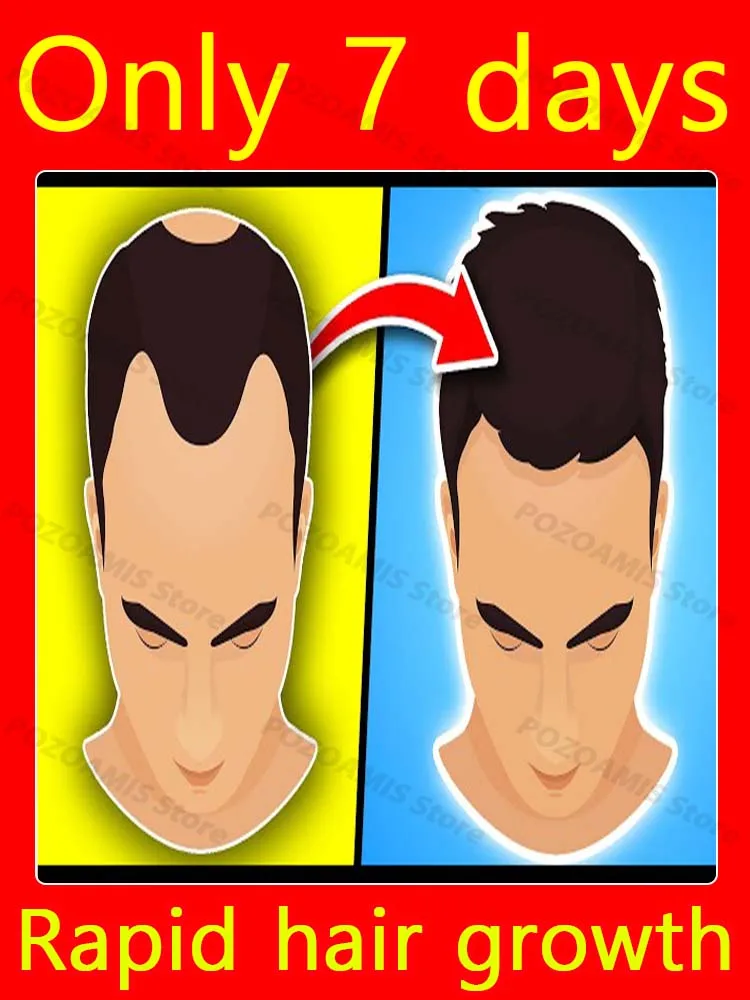 

30 дней, чтобы получить кудрявое море ​ ​ волосы, лоб, линия волос и проборка все сделано