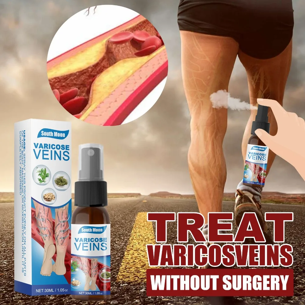 Varicose Vein Spray Vasculitis Phlebitis Spider Legs Smoothing Blood Vessel Bulging Treatment Redness Leg Body Care ﻿30ml 다이어트