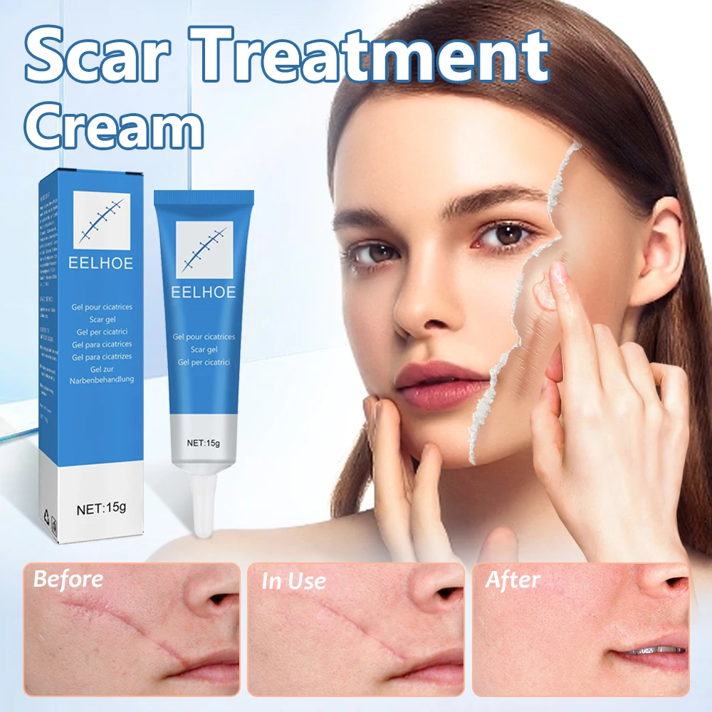 Scar Repair Cream Repairing Scald Moisturizing Rejuvenating Firming Face Repairs Damaged Skin Scar Postoperative Scar Repair