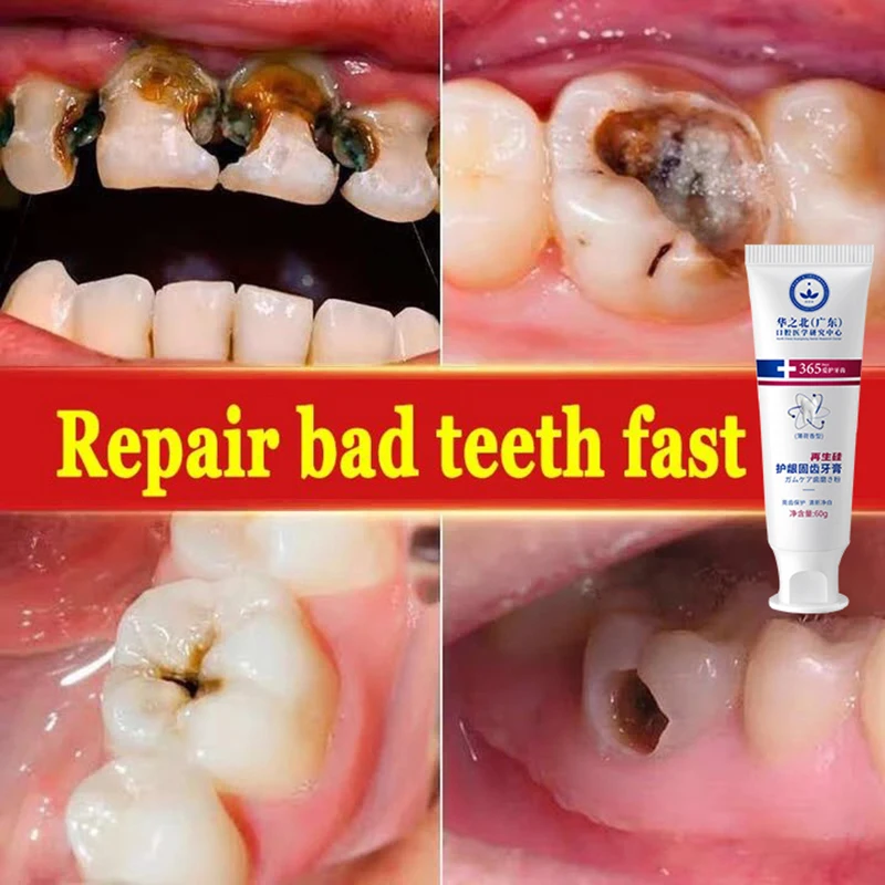 Teeth Whitening Toothpaste Quick Repair of Cavities Caries Fresh Breath Removal of Plaque Repair Teeth Care Product New Upgrade