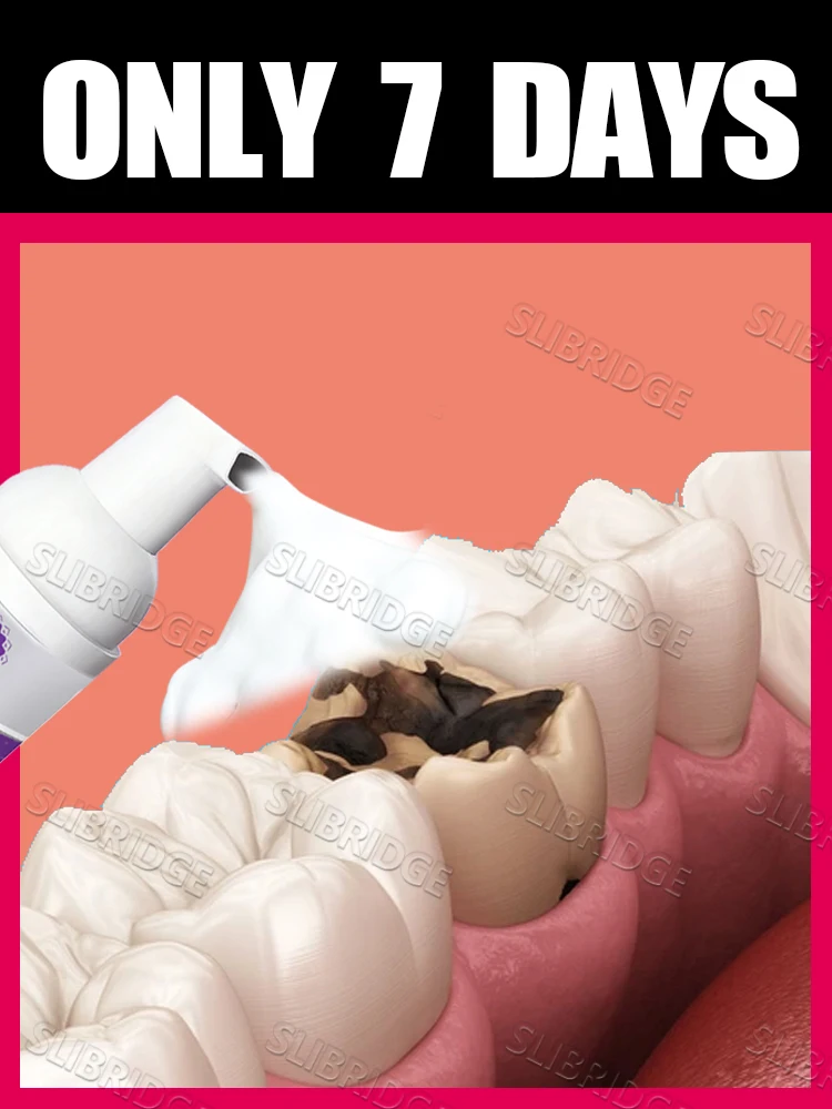 

Mousse solves various problems Intraoral care tools