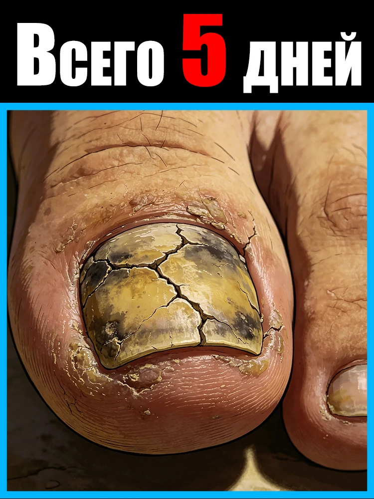 

Мгновенное проникновение и длительное облегчение. 100% надежные результаты.