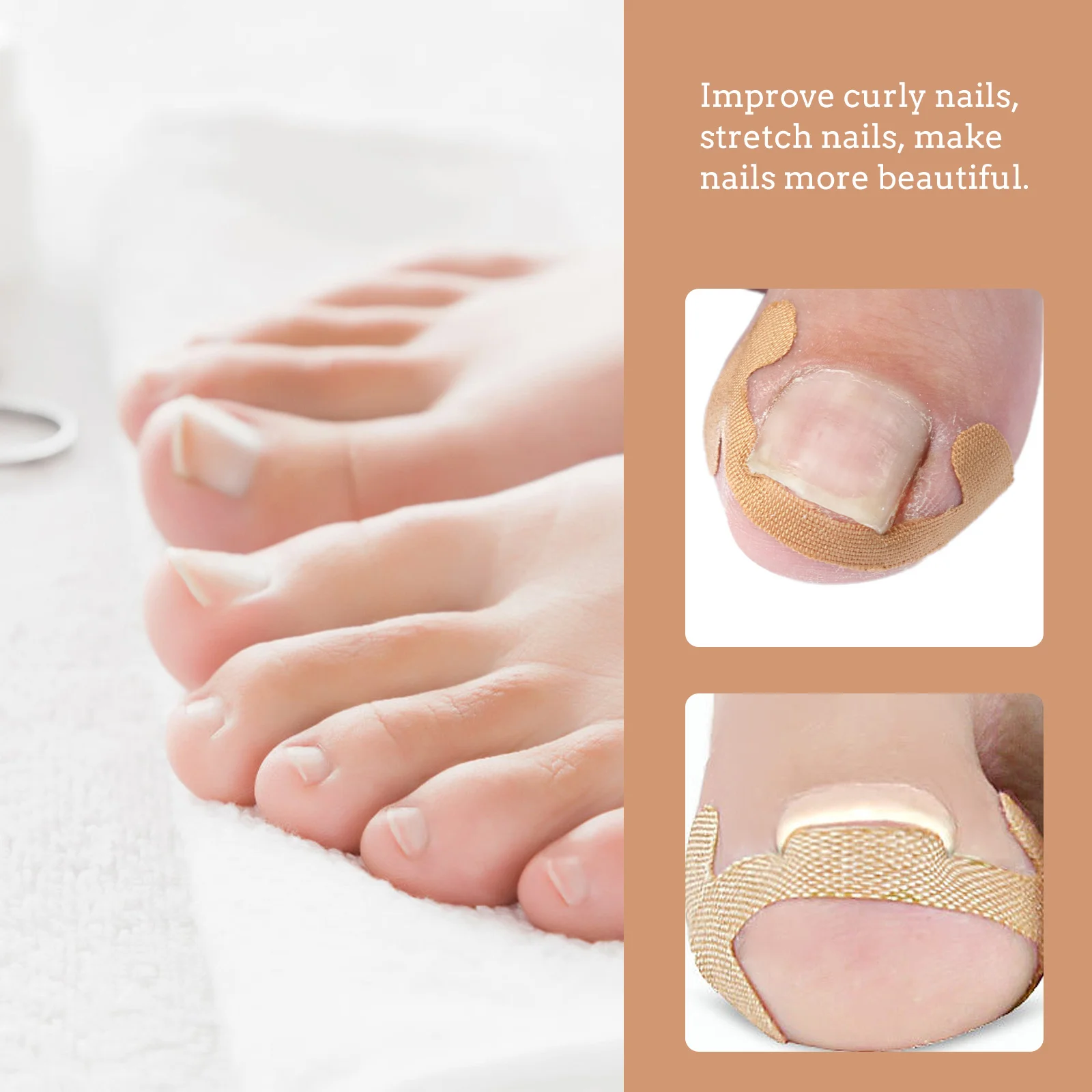 

40Pcs Curved Toenail Correction Stickers No Glue Ingrown Toenail Patch Nail Care Tool Light Brown Men Women Use