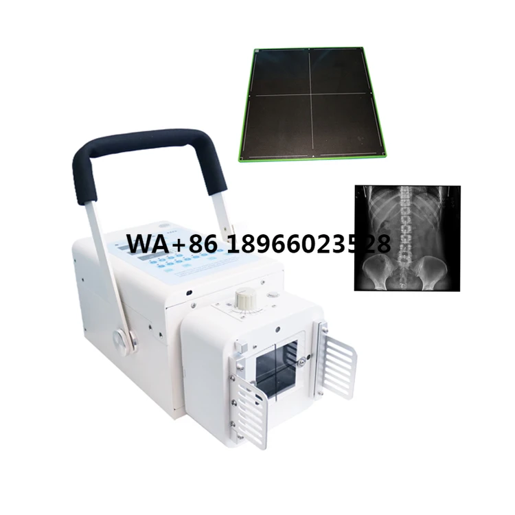 Portable high frequency veterinary x ray portable vet x-ray machine build-in battery