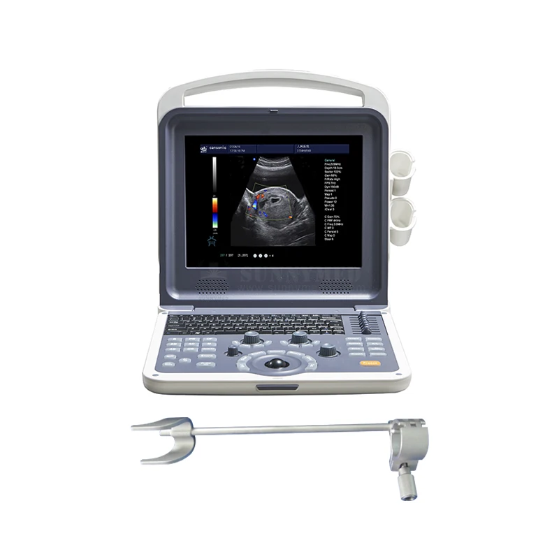 SY-A042N China Medical Portable Ultrasound Scanner Machine Price with 2 Probes Cheapest 4D Upgradable Laptop Color Doppler