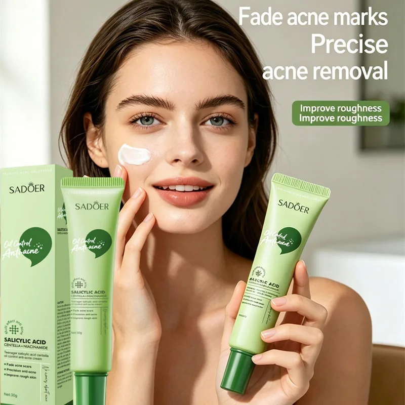 Crema Facial con Ácido Salicílico para el Tratamiento del Acné, Repara las Manchas de Acné, Limpieza Profunda de Poros, Control de Grasa, Hidratante, Cuidado de la Piel
