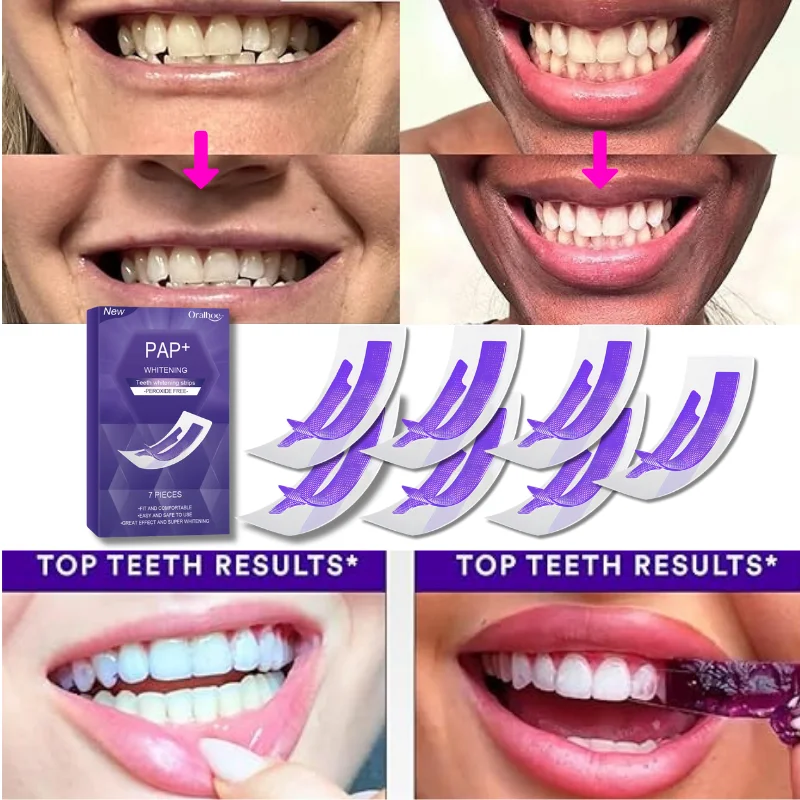 

Purple Teeth Whitening Strips Remove Plaque Stains Cleaning Oral Hygiene Bleaching Dental Tools Fresh Breath Brighten Tooth Care