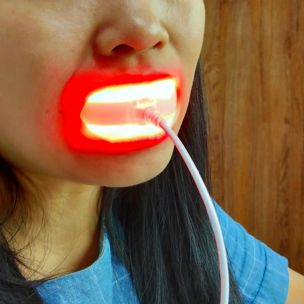 Dental Red Light Therapy Instrument Teeth Pain Cold Sore Canker Treatment Infrared Light for Mouth Oral Physiotherapy Tool