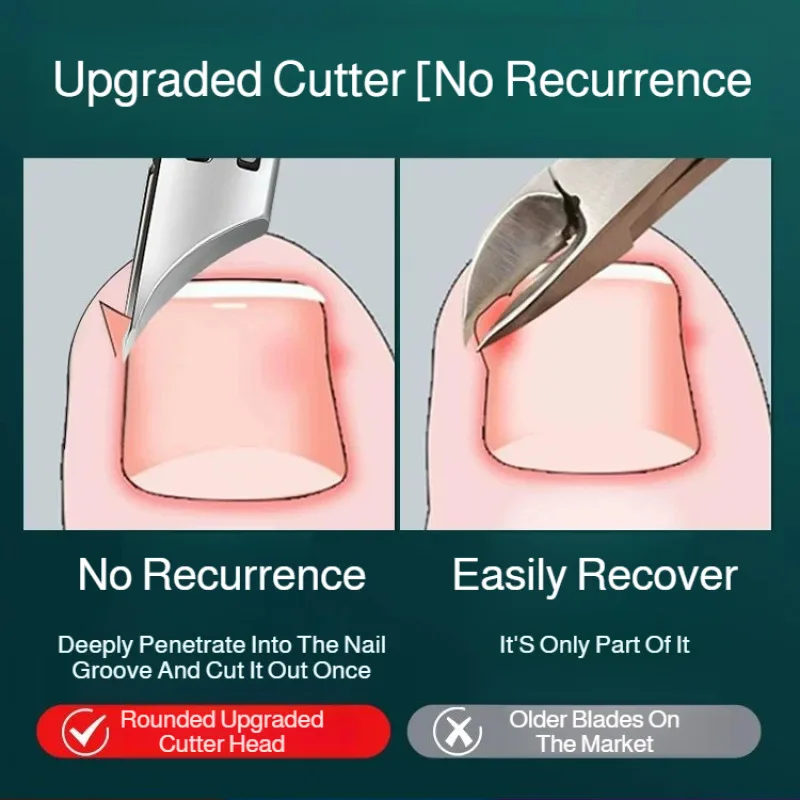 Kit de cortaúñas portátil para el hogar, cortaúñas de punta inclinada de acero inoxidable, herramientas de manicura duraderas y afiladas, para el cuidado de las uñas de los pies en el hogar