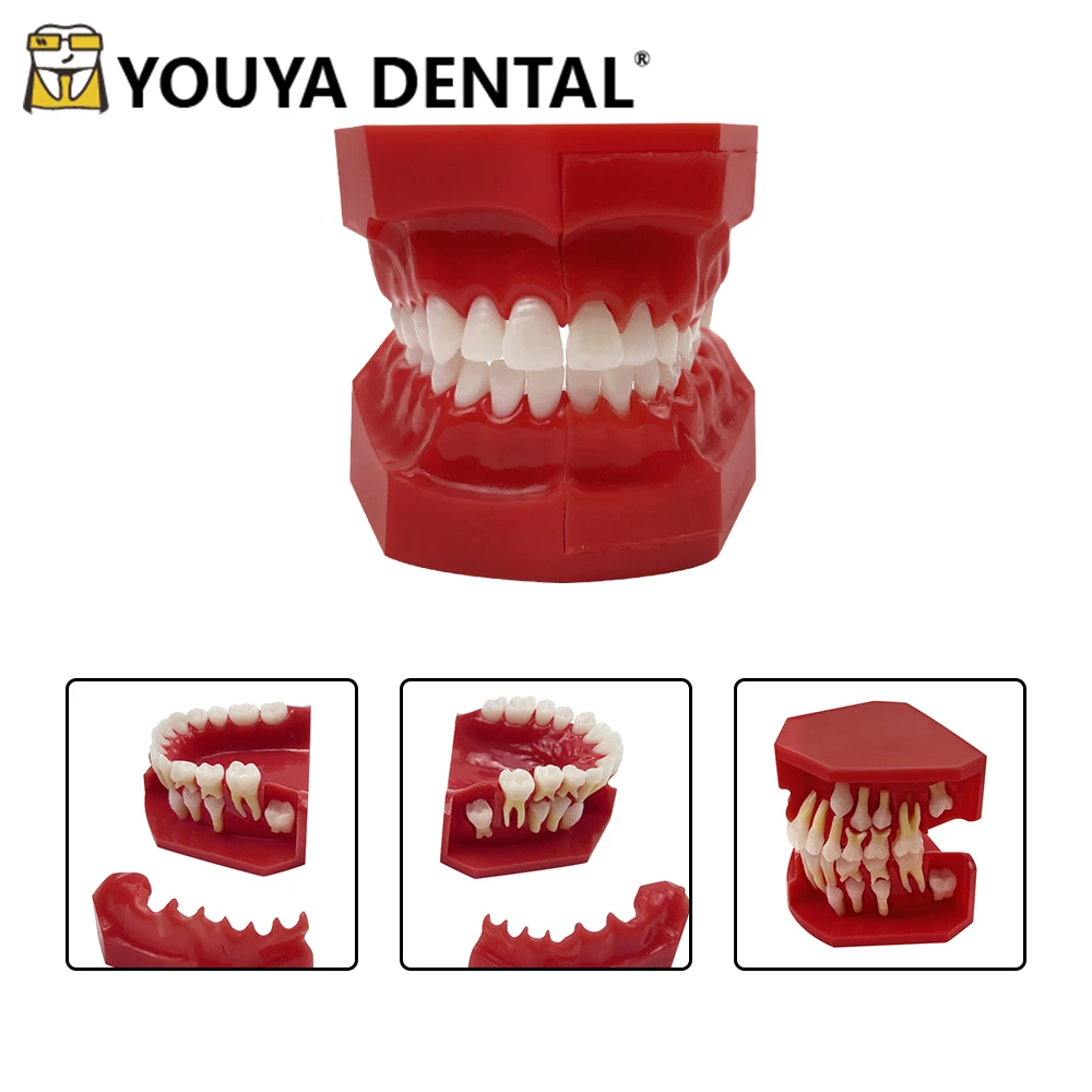 Child Caries Dental Model Primary Permanent Teeth Alternate Model Replacement Teeth Development Demonstration Model Materials