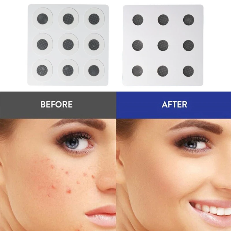 9 Pcs Water Soluble Salicylic Acid Stickers Microneedles Skin Treatment Face Acne Soothing Blemish Pimple Removal Patches