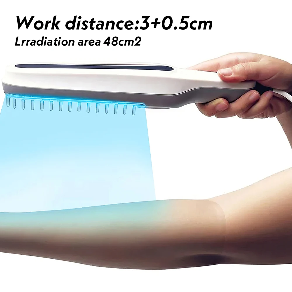 UVB-Lampe für Vitiligo-Phototherapie, Vitiligo-Behandlung, UV-Lampe, Laser-Psoriasis-Lampe, Phototherapie, Vitiligo mit Schutzbrille