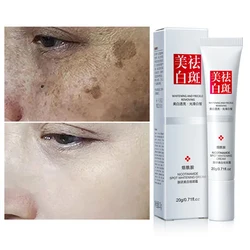 Effective Whiten Cream Brighten Face For Face Spots Remove Dark Spot Melasma Anti-pigmentation Improve Dullness Skin Care Cream