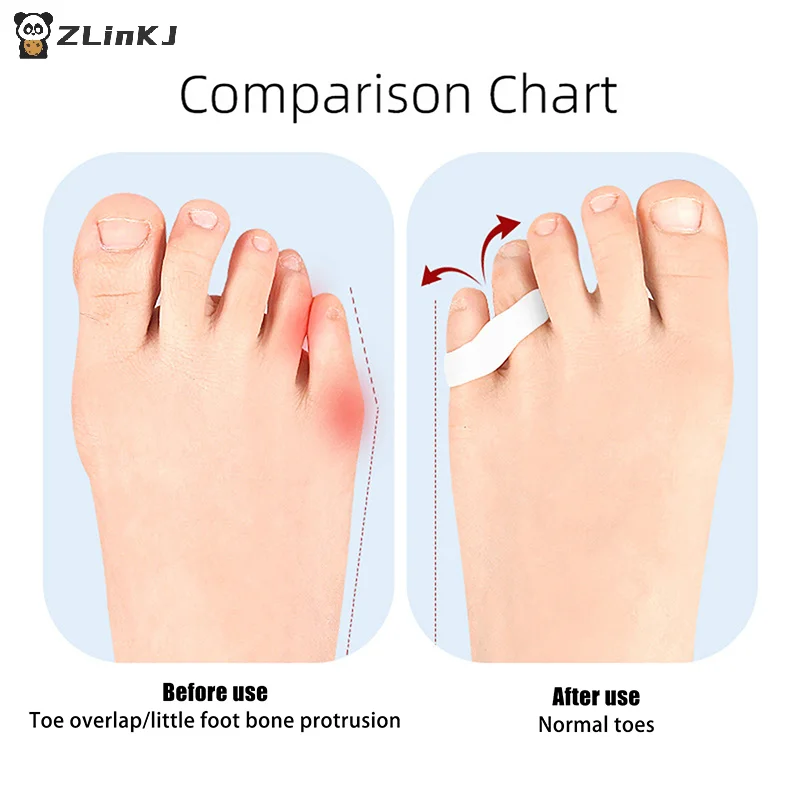 ▶ Corrector de silicona para Hallux Valgus, Gel para el cuidado de los pies, separador de dedos, Protector de dedo pequeño, alisador de juanete, herramienta de pedicura, 1 par