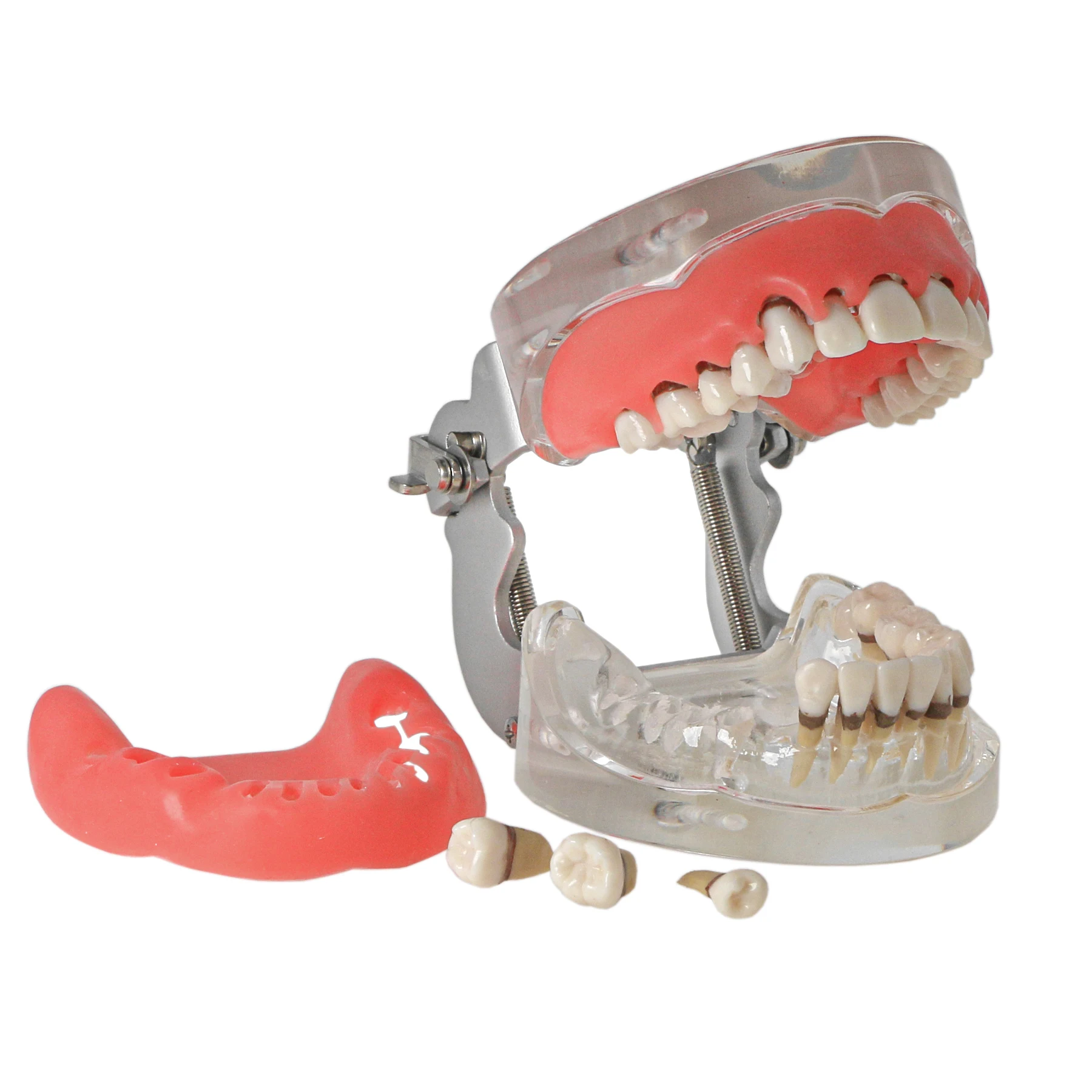 

Dental Teaching Model with Periodontal Disease Dental Model For Training Studying Patient Demo Removable Dentistry Teeth