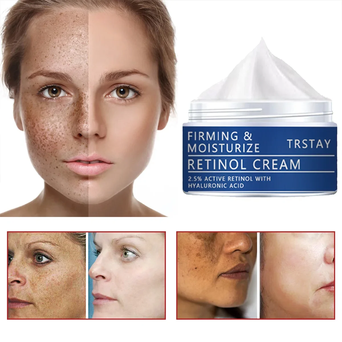 TRSTAY Retinol Crema facial 2.5% Reafirmante y hidratante activo con ácido hialurónico Blanqueamiento Cuidado de la piel para maternidad