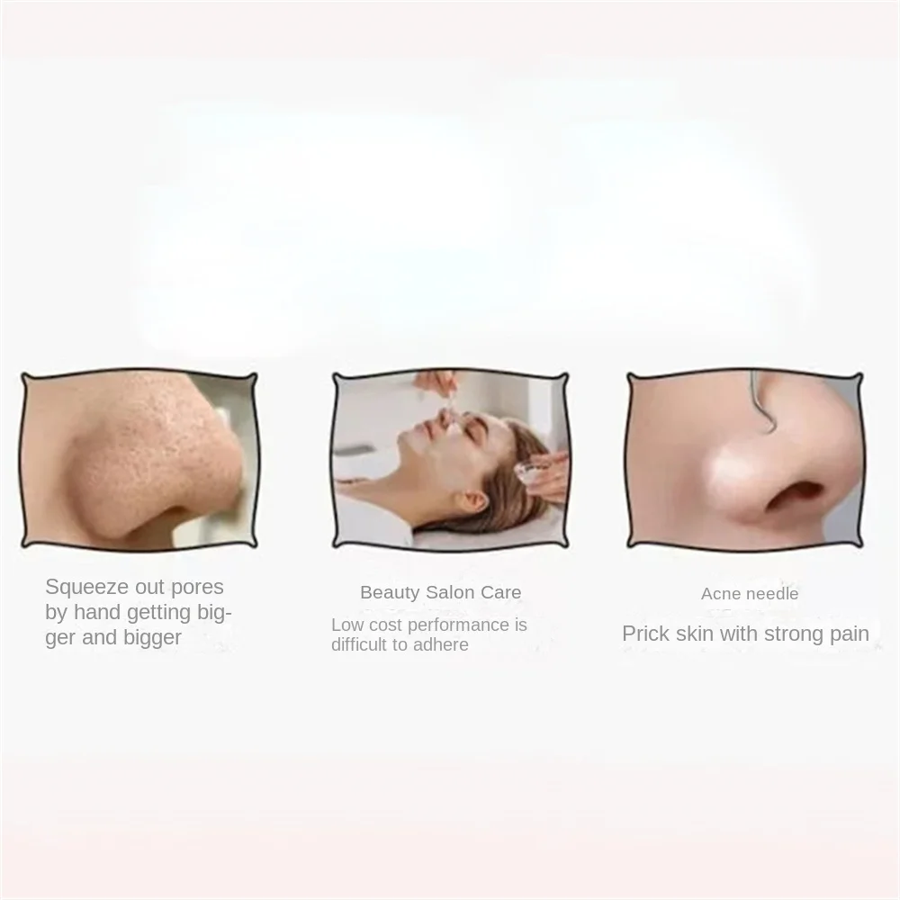 أداة إزالة الرؤوس السوداء والرؤوس البيضاء للأنف والوجه - منظف مسام الجلد أدوات العناية بالبشرة للنساء تنظيف المسام بالنقاط السوداء