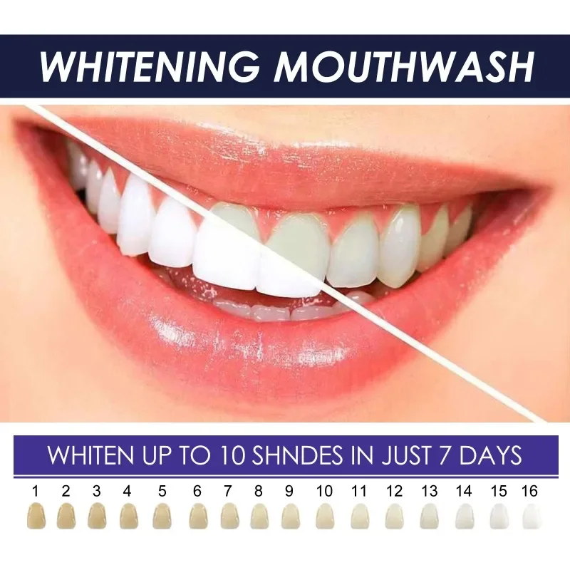 

New Sdottor Whitening Mouth Wash Deep Cleaning yellow teeth tatar Mouthwash Remove Stains Odor Bad Breath Gum care Oral Hygiene