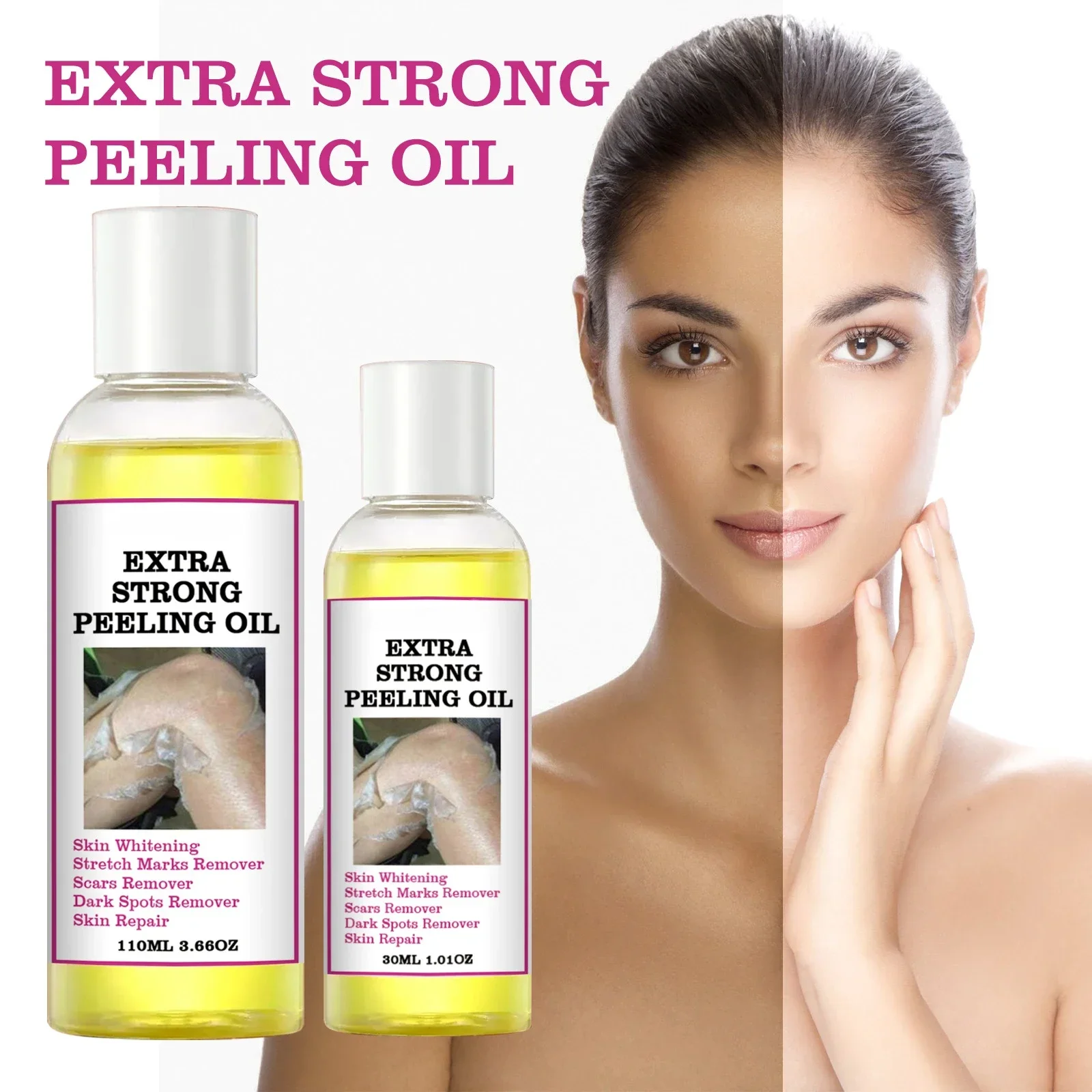 Extra Strong Yellow Peeling Oil Whitening Peeling Oil Lighten Elbows Knees Hands Melanin Even Skin Tone and Whiten Skin 110ml