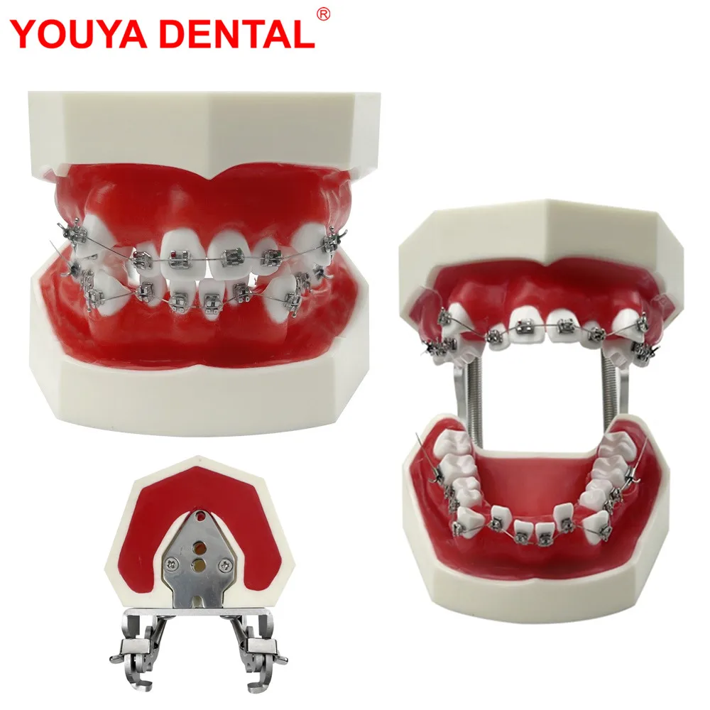 

Orthodontic Model Wax Gum Teeth Model Dental Practice Typodont With Metal Bracket For Ortho Traning Teaching Studying Education