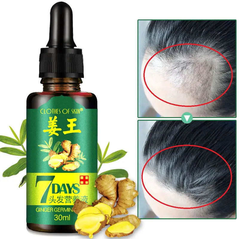 7 Day Ginger Germinal Serum Essence Oil Natural Hair Loss Treatement Effective Fast Growth Hair Care 30ML drop shipping