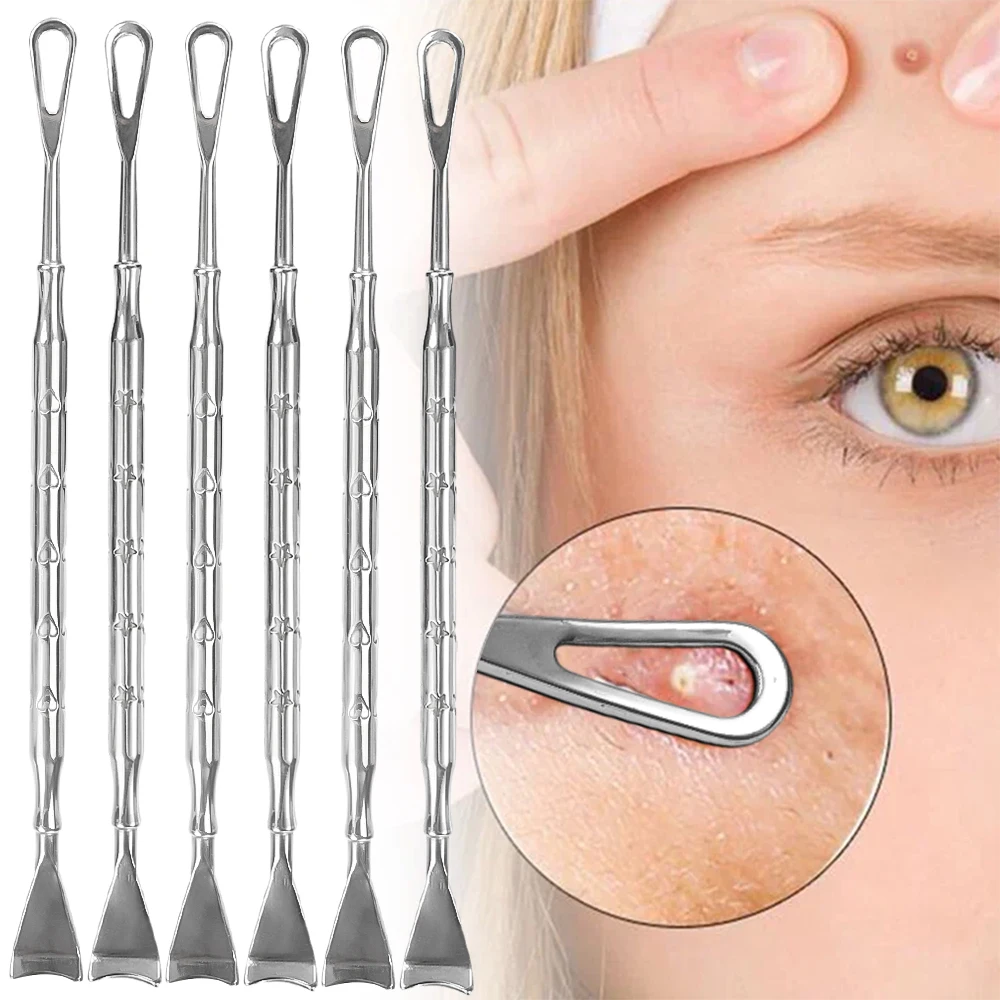 Aguja de acero inoxidable para eliminar espinillas y acné, herramienta de doble cabeza para limpieza de raspado facial, empuje plano, eliminación de espinillas y piel muerta