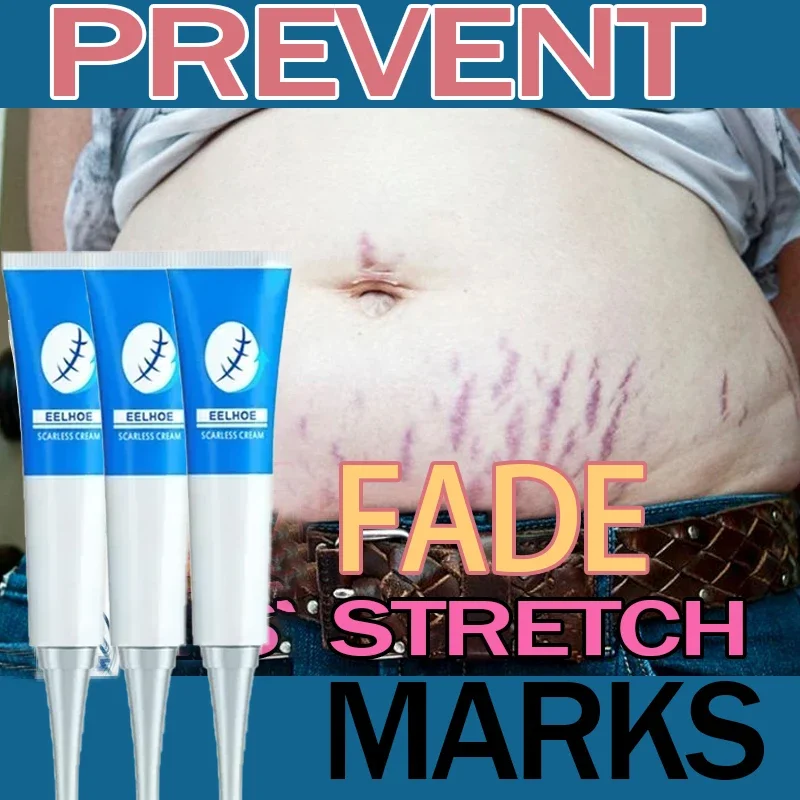 

Stretch Mark Removal Cream Permanently Removes Stretch Marks Rejuvenates Skin Stretch Mark Removal Cream