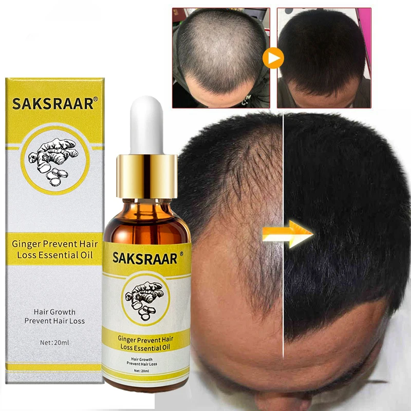 Hair Growth Essential Oils Essence Prevent Hair Loss Health Hair Care Repair Baldness Anti-dropping Promote Hair Grow Serum