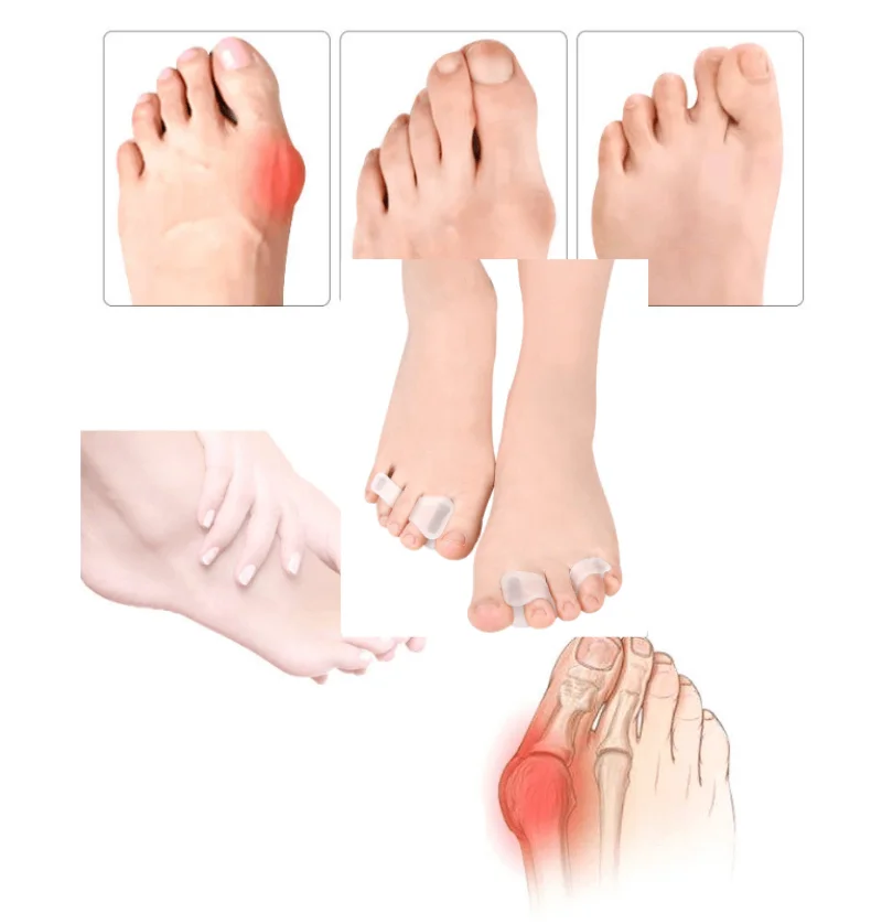

1/2/4Pairs Hallux Valgus Foot Care Pedicure Silicone Gel Straightener Two Hole Toe Separator Fingers Protector Bunion Adjuster