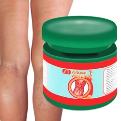 ZB 2024 Varicose Veins Treatment Cream Effective Cure Vasculitis Phlebitis Spider Veins Pain Varicosity Angiitis Ointment 20g
