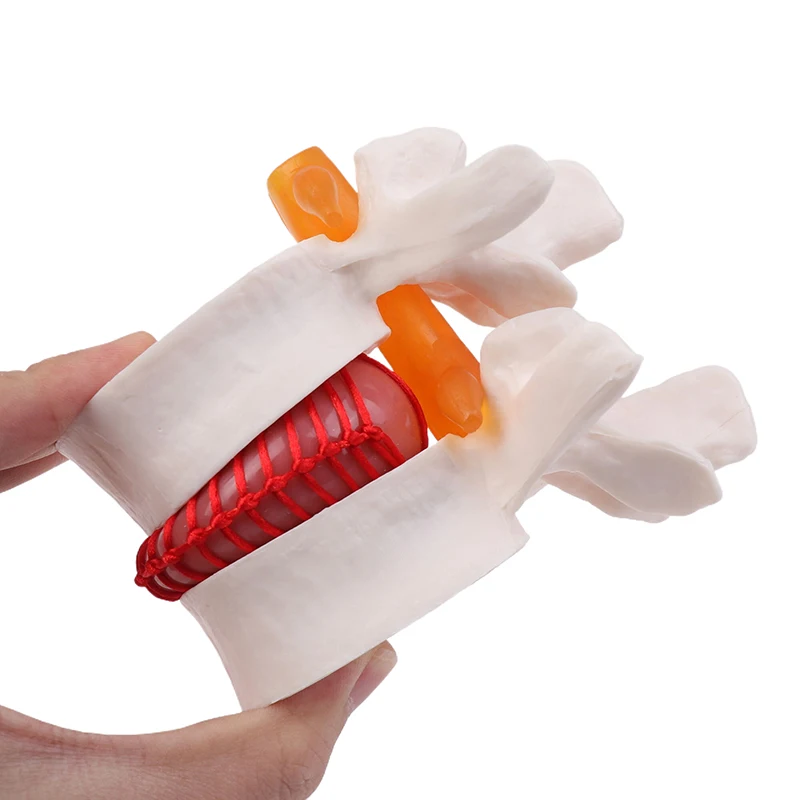 

Human Anatomy Skeleton Spine Lumbar Disc Herniation Teaching Model Brain Skull Traumatic School Supplies Medical Instrument