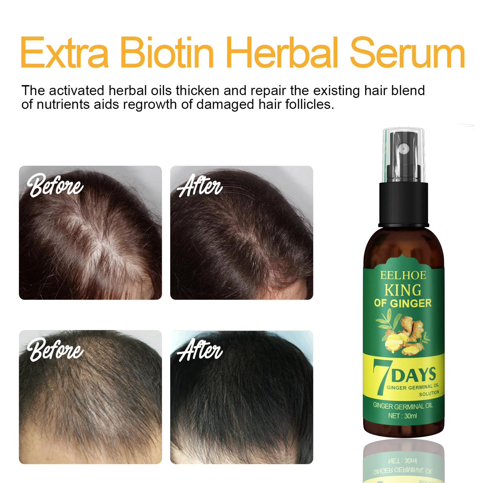 EELHOE Hair Growth Spray 7 Day Ginger Serum Unisex Scalp Damaged Prevent Hair Loss Effective Fast Growth Massage Liquid 50ml