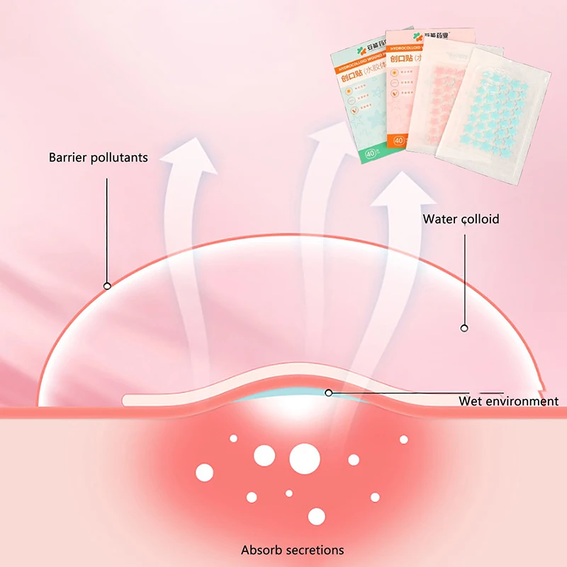 40 шт./лист, невидимый пластырь от прыщей, профессиональный уход за кожей лица, восстановление прыщей, впитывающая пятна, наклейка для мужчин и женщин