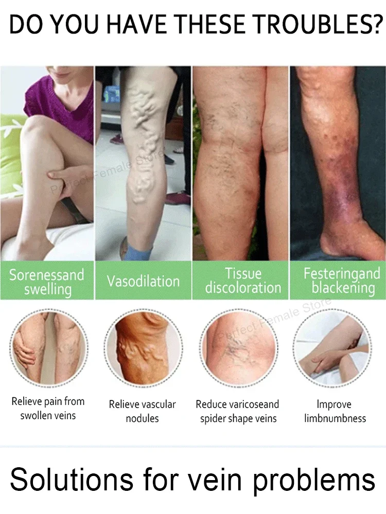 Varicose Veins Products