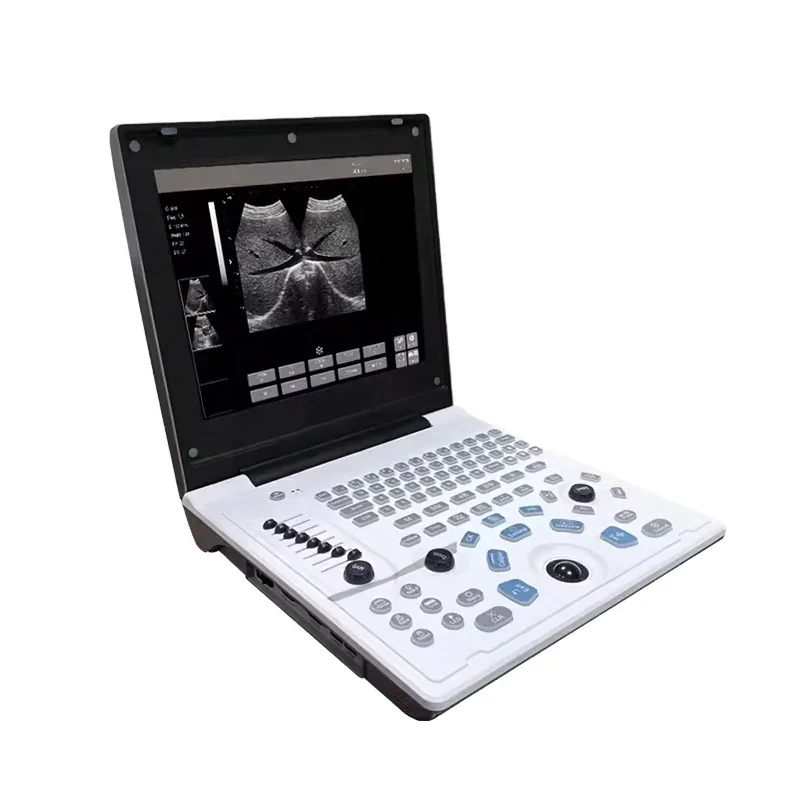

Laptop Portable Animal Ultrasound for Routine Veterinary Exams with 7.5 MHz Probe