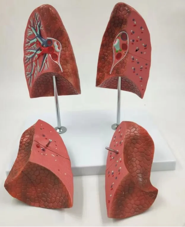 

Lung Model Medical Science Pulmonary Anatomical Simulator Educational Teaching Aids for Medicine College Biology and Hospital