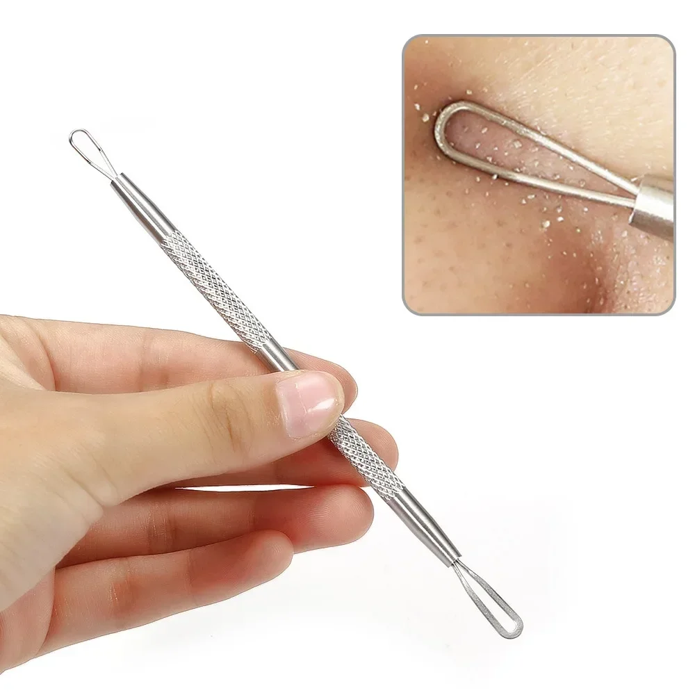 Edelstahl Mitesser Pickel Akne Doppel ringe Squeeze Extractor Tool Gesicht Hautpflege-Tools Beauty-Health