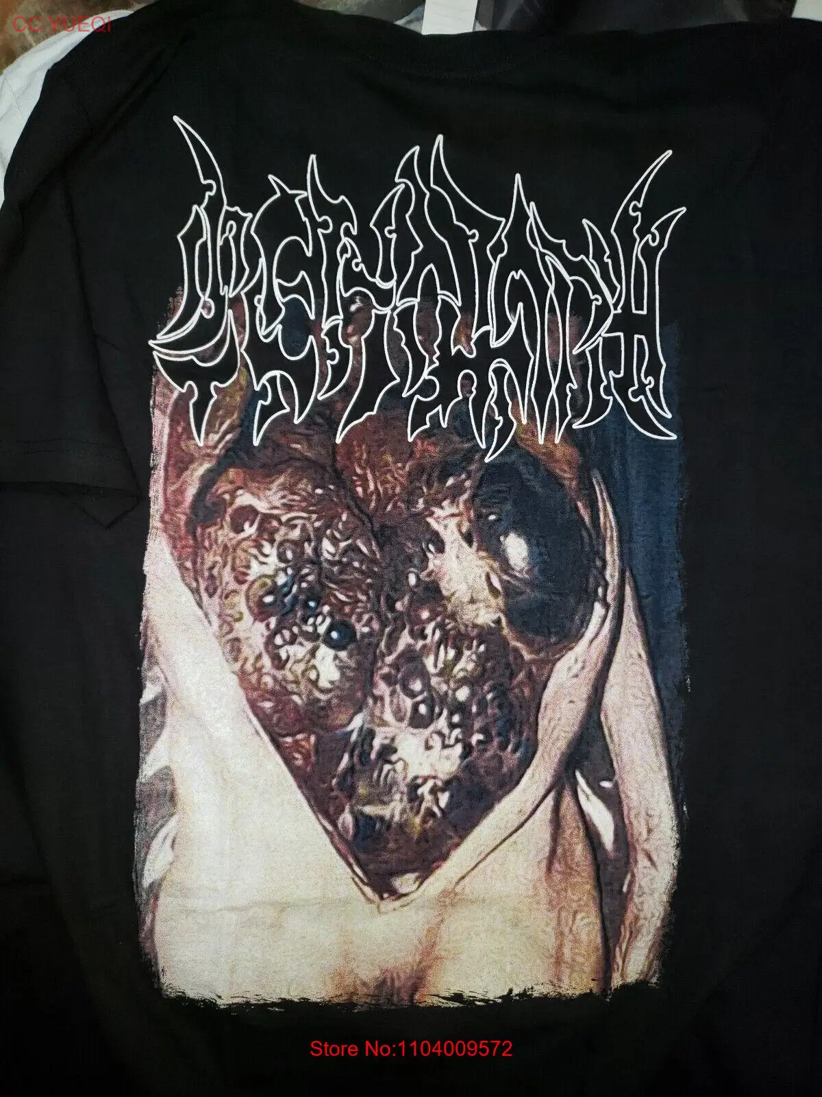Cenotaph-Camisa de desgorgán, deformación Fetal, cavidez