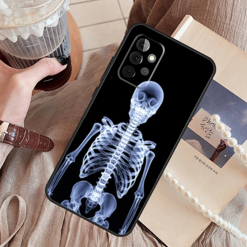 Radiological Human Organs Skeleton Funda Phone Case For Samsung Galaxy A14 A13 A12 A54 A53 A52 A34 A33 A32 A24 A23 A22 A51 A71