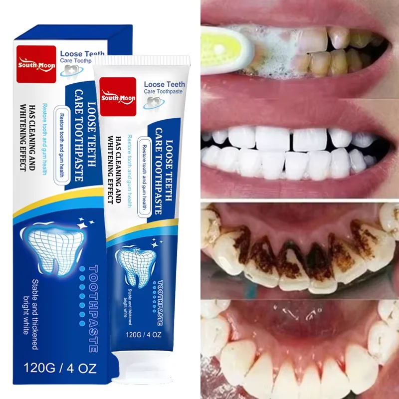 

Whitening Teeth Toothpaste Dental Calculus Remover Fresh Breath Brightening Preventing Periodontitis Dental Cleansing Care New