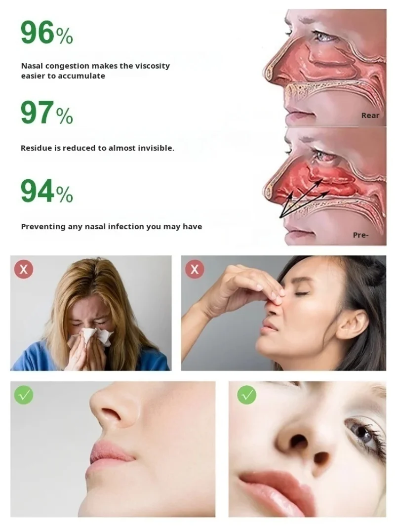 BioNase Nose Rhinitis Sinusitis Cure Therapy Nose Massage Hay Fever Low Frequency Pulse Laser Runny Sneeze Treatment Machine