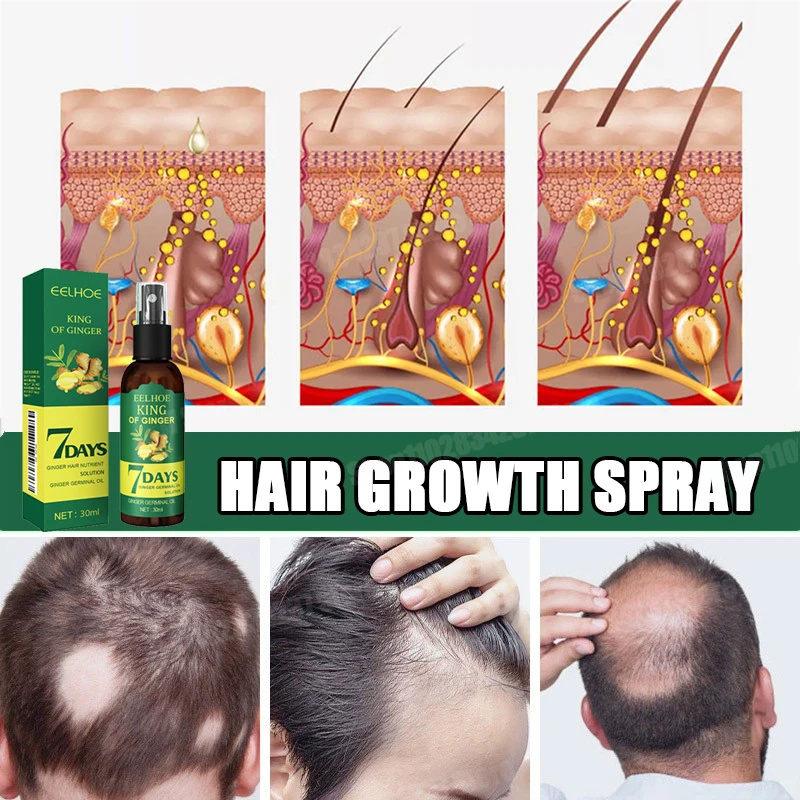 Hair Growth Spray 7 Day Ginger Serum Scalp Damaged Treatement Prevent Hair Loss Effective Fast Growth Massage Liquid